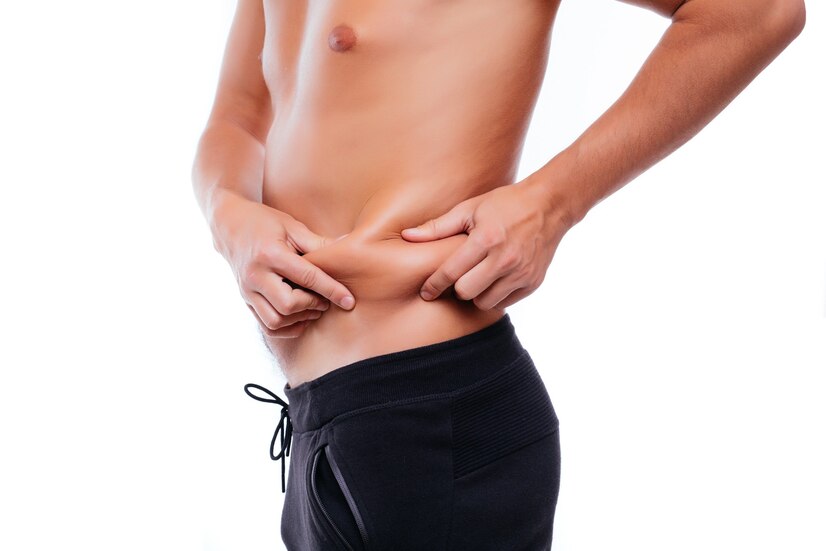 Comment se passe une liposuccion pour un homme