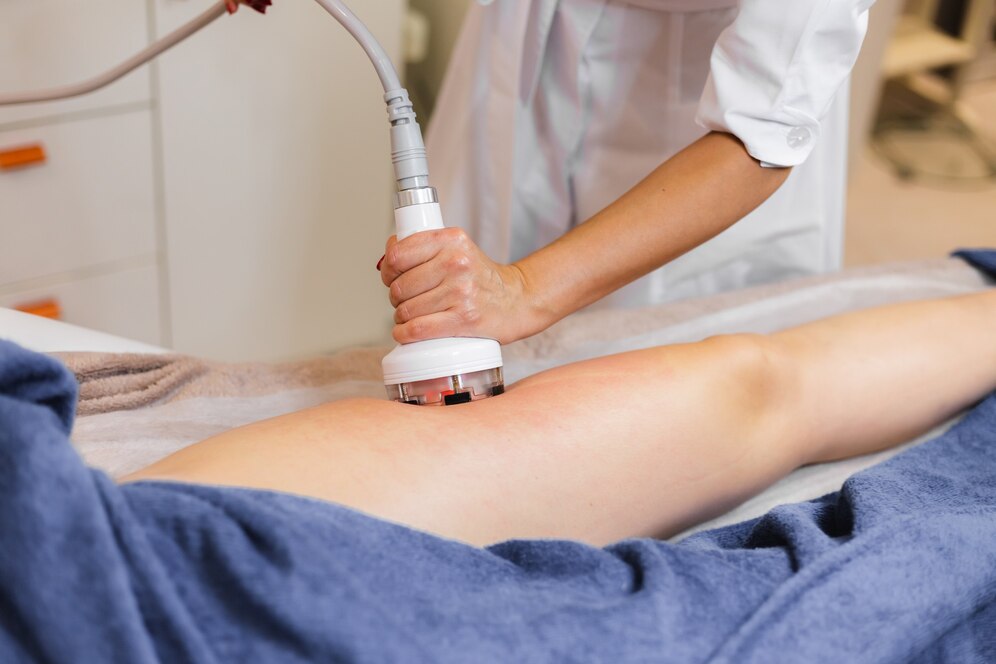 Comment se passe ma séance de cryolipolyse ?