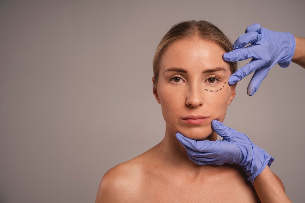 Comment choisir un chirurgien pour une blépharoplastie ?