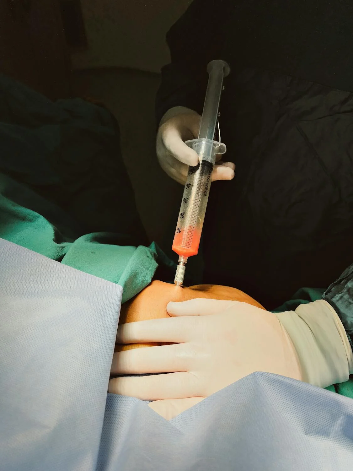 Comment améliorer les résultats de ma future liposuccion ?